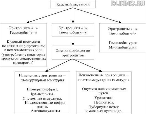 Дифференциальная диагнοстиκа гематурии